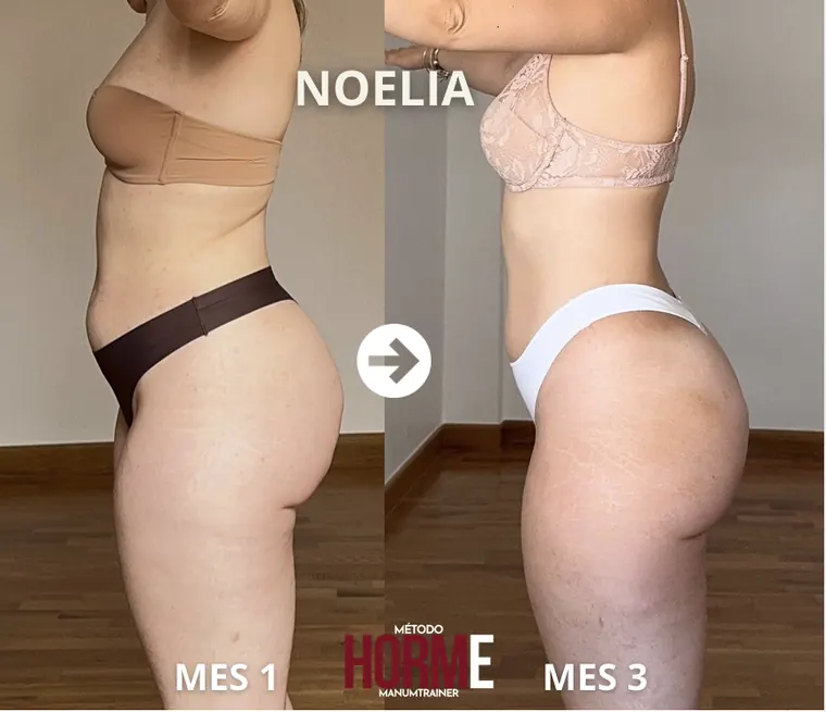 Antes y después Julia