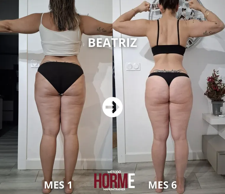 Antes y después Beatriz
