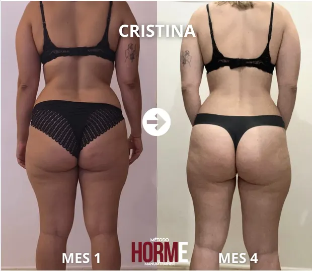 Antes y después Cristina